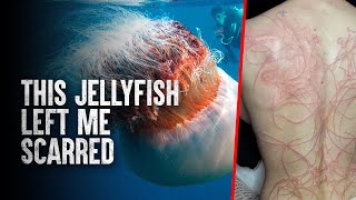 How To Survive The 10 Most Dangerous Jellyfish in the World [upl. by Nylram382]