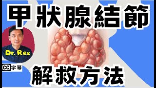 如何改善甲狀腺結節？ 什麼病徵顯示甲狀腺結節是腫瘤？ [upl. by Reitrac]