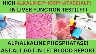 Liver Function Test Report Interpretation LFTsASTALTALP CAUSES OF HIGH LOW ALKAINE PHOSPHATASE [upl. by Aekerly]