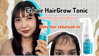 Rontok parah langsung sembuh pake Erhair HairGrow Tonic [upl. by Anowahs671]