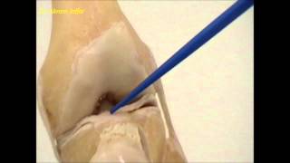 Anatomy of the knee joint [upl. by Idnak]