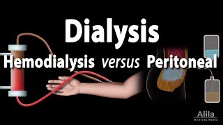 Renal Replacement Therapy Hemodialysis vs Peritoneal Dialysis Animation [upl. by Neelia]