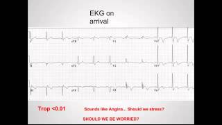 Wellens Syndrome quotEM in 5quot [upl. by Ernaline]