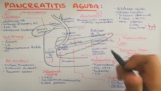 Pancreatitis causas fisiopatología clínica diagnóstico y tratamiento [upl. by Gayel82]