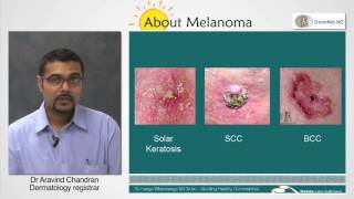 Melanoma Risk Factors [upl. by Yortal]