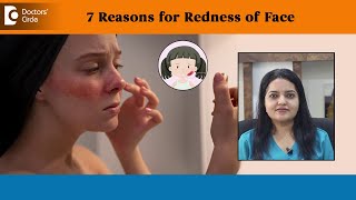 7 Reasons for Redness of Face Erythema Sunburn Rosacea  Dr Urmila Nischal  Doctors Circle [upl. by Annaeoj]