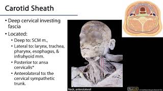 Carotid Sheath  Posterior Neck LO [upl. by Severn164]