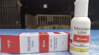 KETO LOTION USE  review in Hindi हेयर फंगस को दूर करने के लिए अपनाएं यह अचूक लोशन [upl. by Fuchs]