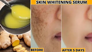 Best Skin👆🏼Whitening Serum Remove Pigmentations झाइयां Dark Spots SunTan Get Fair Bright Skin [upl. by Ytiak]