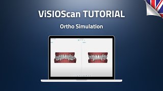 10Ortho Simulation [upl. by Angelita]