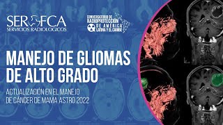 Gliomas de alto grado diagnóstico y tratamientos actualizados [upl. by Magen730]