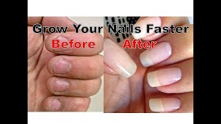 How to grow Nails Faster at Home  Easy Nails Growth idea  how to grow long nails [upl. by Lontson120]