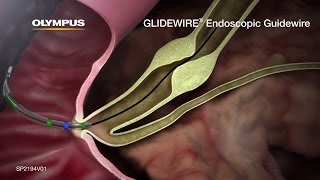 GLIDEWIRE Endoscopic Hydrophilic Coated Guidewire Animation [upl. by Artimid810]