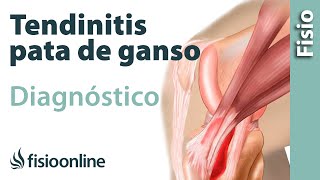 Cómo saber si tengo tendinitis de la pata de ganso [upl. by Schlessel]