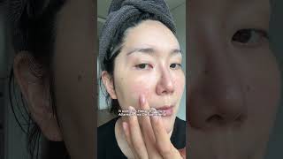 KOREAN PHARMACY TOP ACNE RECS by my Pharmacist MOM🙌 [upl. by Pedersen897]