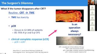 DocTalk Dr Josh Smith on Nonoperative Management in Rectal Cancer [upl. by Htrag]