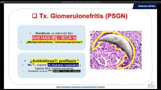Síndrome nefrítico  GMN IgA o Berger Alport vs postestreptocócica nefritis lúpica Goodpasture [upl. by Terrijo834]