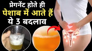 प्रेगनेंट होते ही पेशाब में आते हैं ये 3 बड़े बदलावpregnancy ke lakshanpregnancy [upl. by Inalawi967]