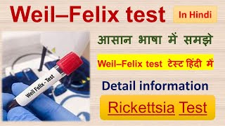 Weil–Felix test  Test for Rickettsia  Detail information in Hindi [upl. by Trahern300]