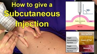 How to Give a Subcutaneous Injection Video [upl. by Bar]