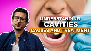 Understanding Cavities [upl. by Oirotciv617]