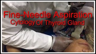 Fine Needle Aspiration Cytology Thyroid Gland  Urdu  Hindi [upl. by Llehsam]