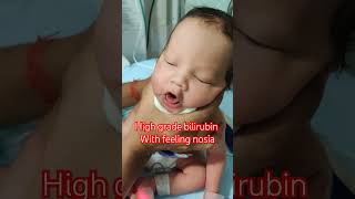 High grade bilirubin with feeling nosia New born after 3 days condition nicu reels newbornbaby [upl. by Akinehc372]