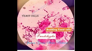 Yeast cell under microscope Sputum gram stain Yeast cells in sputum [upl. by Roxy]