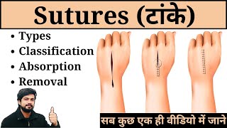 Sutures  Types Classification Removal and Absorption in Hindi  Nursing  Surgery  Medical  GNM [upl. by Ylrebmi]