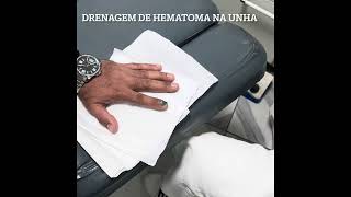 Sangue pisadodrenagem de hematoma [upl. by Gabriel149]