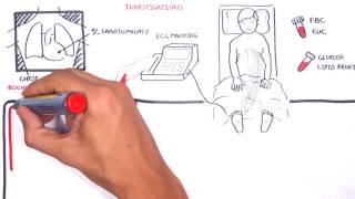 Acute Coronary Syndrome DETAILED Overview MI STEMI NSTEMI [upl. by Argus79]