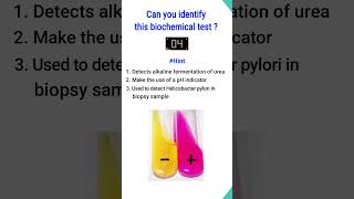 Quiz5  Biochemical test for identification of bacteria shorts microbiology [upl. by Hutner]