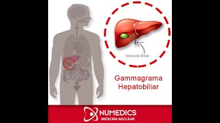 Gammagrama Hepatobiliar [upl. by Kcinnay]