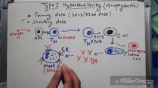 Type 1 hypersensitivity hindi [upl. by Erotavlas543]