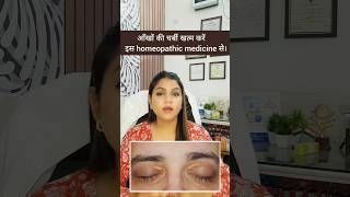 आखों पर जमा फैट हटाए आसानी से  Xanthelasma Treatment Easy And Simple Treatment [upl. by Atteloj199]