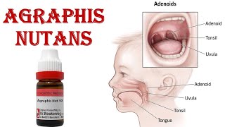 AGRAPHIS NUTANS ADENOID [upl. by Merrick]