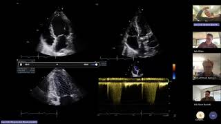 DDU Viva Cases  Part 3 [upl. by Ludeman]