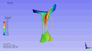 Finite element model of a mitral valve [upl. by Glyn109]