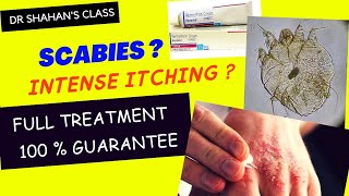 Scabies Treatment  100  sure treatment scabies treatmentplan dermatology [upl. by Tolland384]