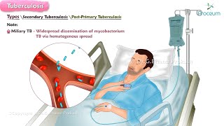 Tuberculosis🫁🦠  Microbiology  Clinical features  Diagnosis  Treatment [upl. by Jollanta]