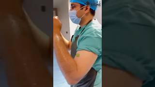 Urethral stone treatment  Removal of urethral stone  RIRS  Retrograde Intrarenal Surgery shorts [upl. by Marb]