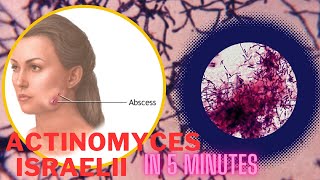 actinomyces microbiology lecture actinomyces israelii Easy Microbiology [upl. by Giustina996]