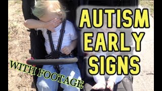 AUTISM EARLY SIGNS  Two Years Old Incl Footage [upl. by Alexis131]