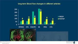Bypass surgery for Moyamoya  MASSIN Congress Day 1  Session 2 Talk 6 [upl. by Cleodel]