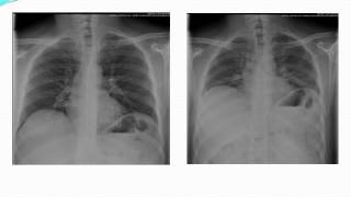 CARDIOLOGIE Techniques d’exploration radiologique du thorax [upl. by Allicserp]