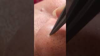 Hair removal on the noseremove hair from noseMens nose hair removalshorts [upl. by Ainniz]