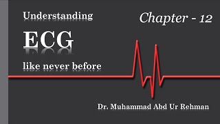 Learning ECG like Never before Ch12  SVT AVNRT OrthodromicAntidromic AVRT amp Retrograde Pwaves [upl. by Nairdna321]