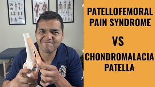 Chondromalacia Patella vs Patellofemoral Pain Syndrome [upl. by Ellac]