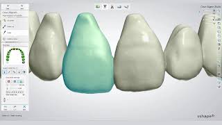 3Shape Clear Aligner Studio workflow with Bernhard Egger [upl. by Ralf524]