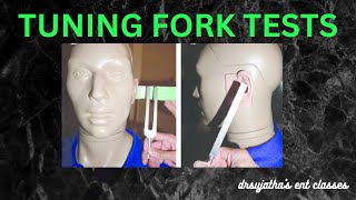 022 Tuning Fork Tests ear clinicalexamination [upl. by Phillada]